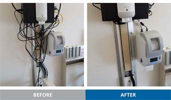 Before and After Photos